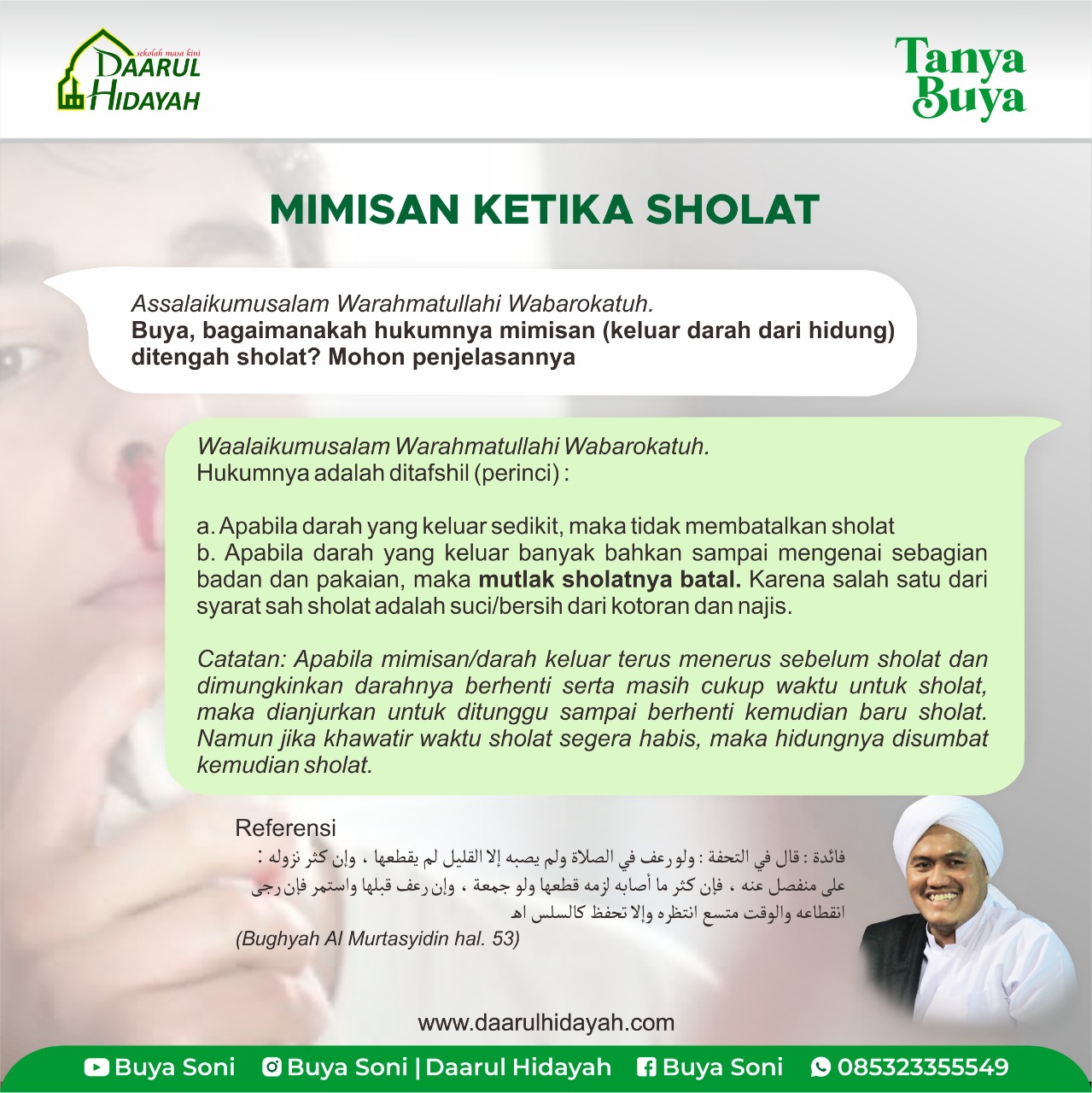MIMISAN KETIKA SHOLAT